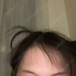 TCB東京中央美容外科 立川院口コミ