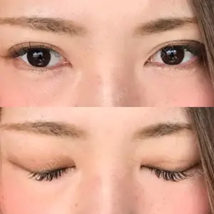 大阪梅田中央クリニック美容外科口コミ