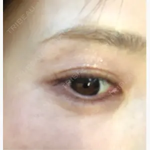 Natural Skin Clinic 笹塚院口コミ