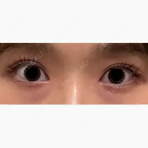 東京イセアクリニック口コミ