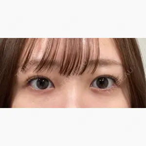 藤井美容外科口コミ