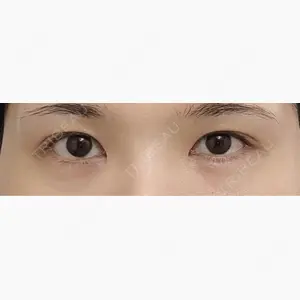 LUHO（ルホ）美容外科口コミ