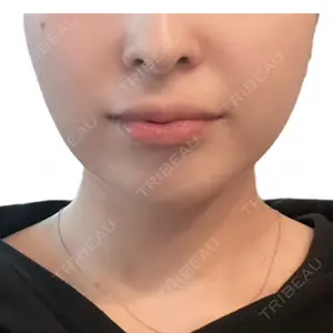 X CLINIC 大阪院口コミ