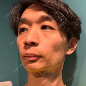 南青山コスメクリニック口コミ