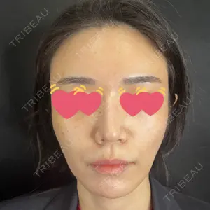 藤・ナチュレ美容クリニック 銀座院口コミ