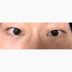 お茶の水美容形成クリニック口コミ