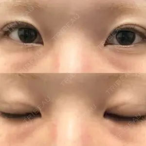 オアシス美容外科口コミ