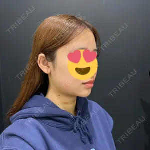 HAAB×DREAM BEAUTY CLINIC 東京本院口コミ