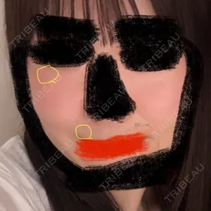 あいちビューティークリニック口コミ