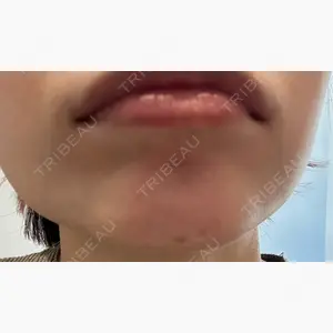 ルラ美容クリニック 札幌院口コミ