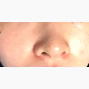 東京形成美容外科 銀座院口コミ