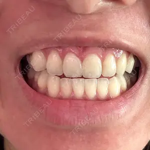 ミライデンタルクリニック口コミ