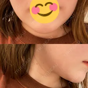 A CLINIC（エークリニック） 仙台院口コミ