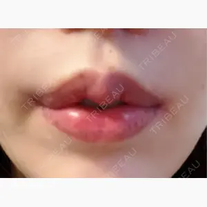 R Beauty CLINIC 銀座院口コミ