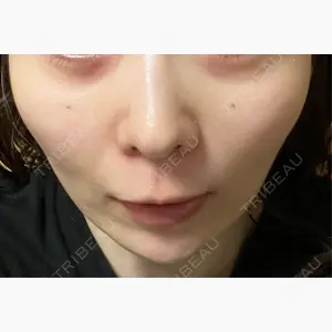まゆりなclinic 名古屋栄口コミ