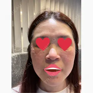 X CLINIC 大阪院口コミ