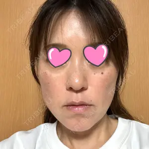 X CLINIC 大阪院口コミ