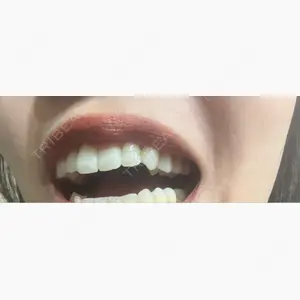 A CLINIC（エークリニック） デンタル 銀座口コミ