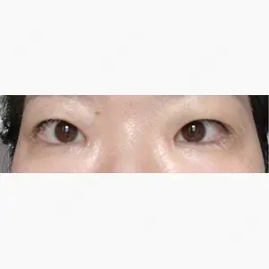 聖心美容クリニック 銀座院口コミ