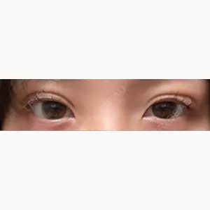 ルラ美容クリニック 神戸院口コミ