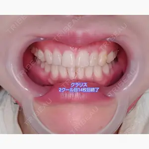 オーラルビューティークリニック クラリス審美歯科・矯正歯科口コミ