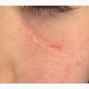 酒井形成外科口コミ