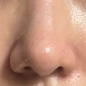 阪田美容・整形外科口コミ