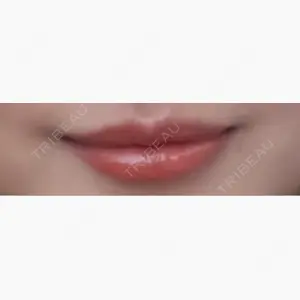 HAAB×DREAM BEAUTY CLINIC 大阪梅田院口コミ
