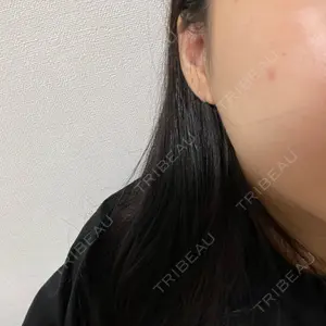 Natural Skin Clinic 笹塚院口コミ