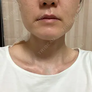 HAAB×DREAM BEAUTY CLINIC 大阪梅田院口コミ