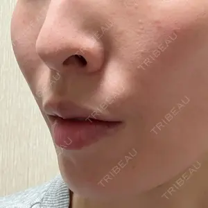 ルラ美容クリニック 名古屋本院口コミ