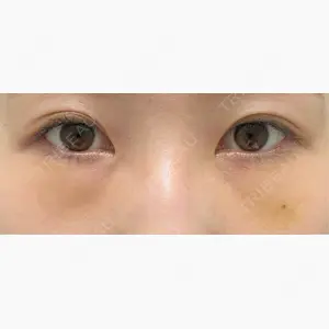 湘南美容クリニック 神戸三宮院口コミ