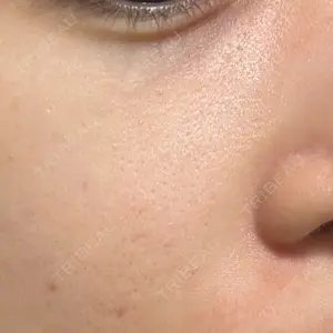芦屋美容クリニック 銀座院口コミ