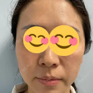 プラザ美容外科口コミ