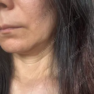 Natural Skin Clinic 自由ヶ丘院口コミ