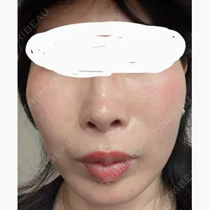 東京シルククリニック 新宿院口コミ