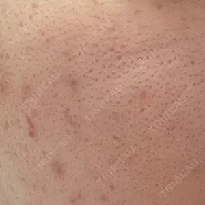 ルラ美容クリニック 沖縄院口コミ