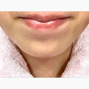 ルラ美容クリニック 名古屋本院口コミ