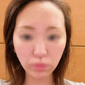 湘南美容クリニック 池袋東口院口コミ