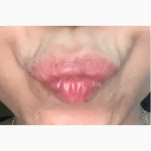 代々木駅前美容クリニック口コミ