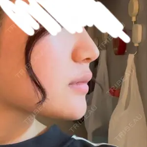 東京美専クリニック口コミ