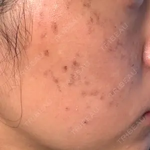 PRESIA Beauty Clinic【プレシアビューティークリニックナガノ】口コミ