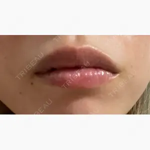 ルラ美容クリニック 新宿院口コミ