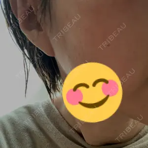 ルラ美容クリニック 千葉院口コミ