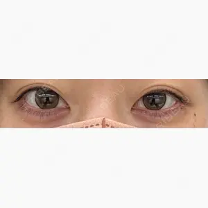 渋谷美容外科クリニック 新宿院口コミ