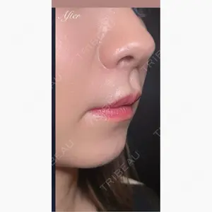 R Beauty CLINIC 銀座院口コミ