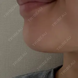 TCB東京中央美容外科 青森院口コミ