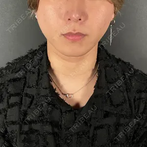 R Beauty CLINIC 大阪院口コミ