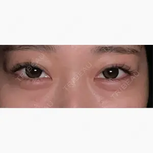 ルラ美容クリニック 広島院口コミ