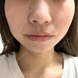 ルラ美容クリニック 大宮院口コミ